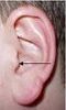 ear.jpg